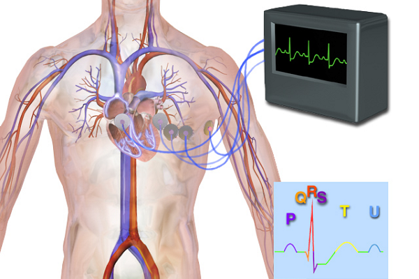 Electrocardiogram